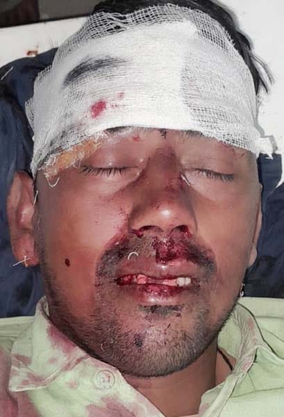खुटार में टकराने के बाद क्षतिग्रस्त कार और ट्रैक्टर। संवाद खुटार में टकराने के बाद क्षतिग्रस्त कार और ट्रैक्टर। संवाद