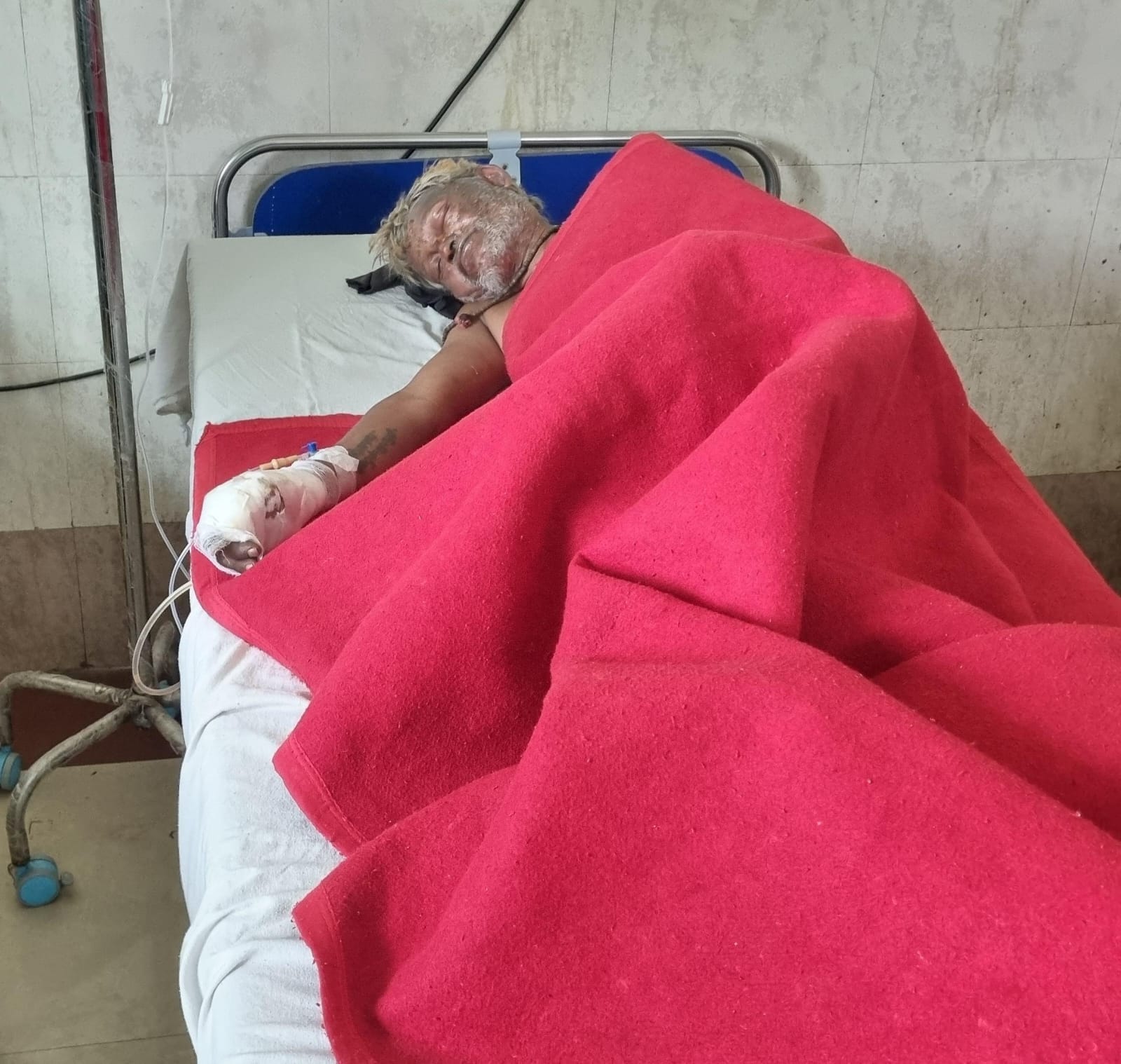 - बिजली का तार टूटने से निकली चिंगारी से जलकर खाक होती झोपड़ी। संवाद - बिजली का तार टूटने से निकली चिंगारी से जलकर खाक होती झोपड़ी। संवाद