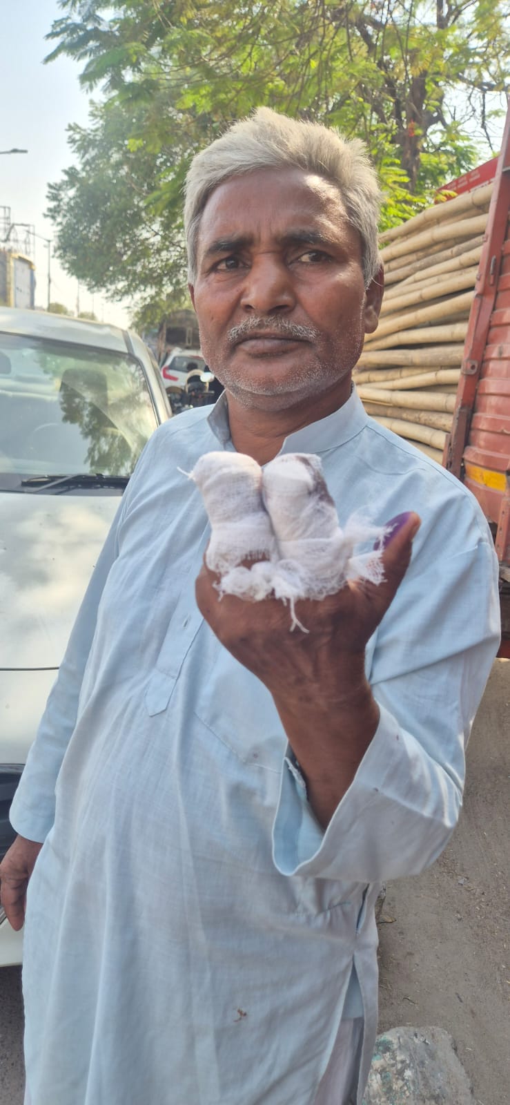 घायल फजलू व कटी अंगुली। घायल फजलू व कटी अंगुली।