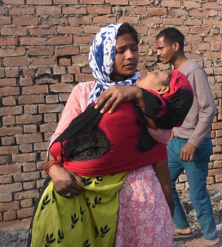 विकास नगर सेक्टर-12 में झुग्गी बस्ती में हुए अग्निकांड के दूसरे दिन कूछ ये रहे हालात।