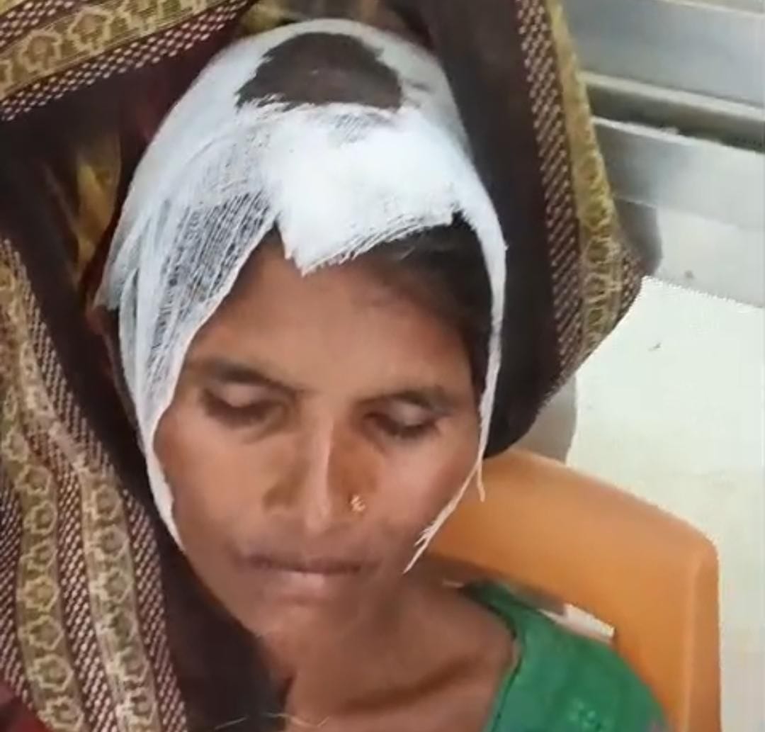 फोटो-35- घायल जगरानी देवी। संवाद फोटो-35- घायल जगरानी देवी। संवाद