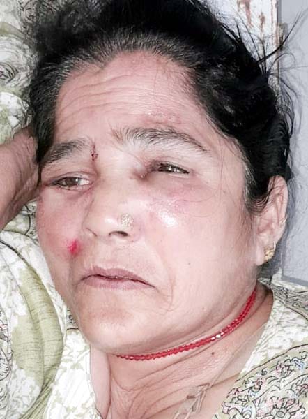 खुटार में गोला रोड पर पलटी बोलेरो। संवाद खुटार में गोला रोड पर पलटी बोलेरो। संवाद