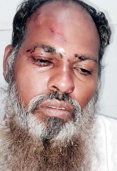 खुटार में गोला रोड पर पलटी बोलेरो। संवाद खुटार में गोला रोड पर पलटी बोलेरो। संवाद
