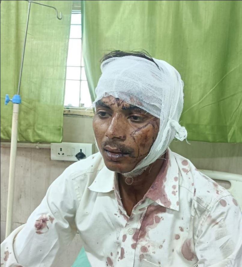 फोटो-22 दुर्घटना के बाद इटावा-बरेली हाईवे पर खड़ी टक्कर मारने वाली डीसीएम। संवाद फोटो-22 दुर्घटना के बाद इटावा-बरेली हाईवे पर खड़ी टक्कर मारने वाली डीसीएम। संवाद