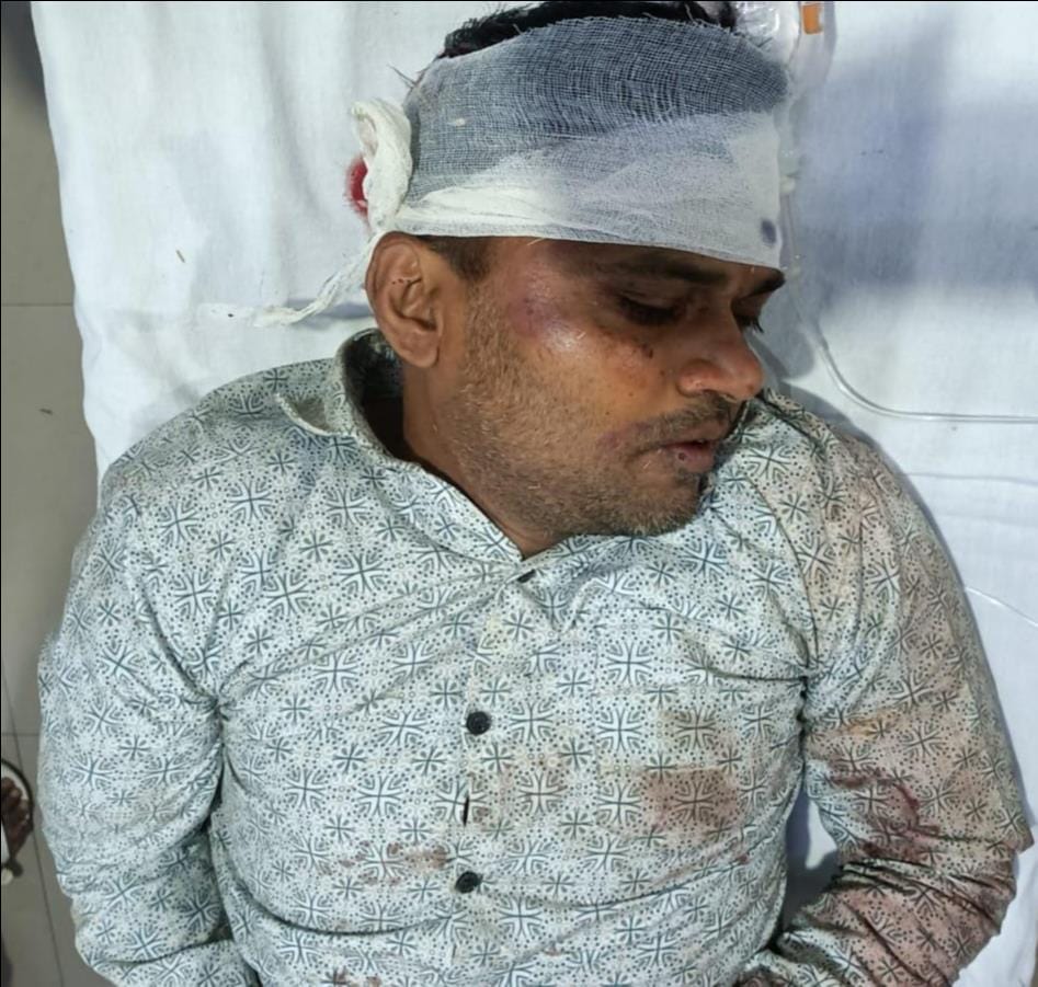 फोटो-22 दुर्घटना के बाद इटावा-बरेली हाईवे पर खड़ी टक्कर मारने वाली डीसीएम। संवाद फोटो-22 दुर्घटना के बाद इटावा-बरेली हाईवे पर खड़ी टक्कर मारने वाली डीसीएम। संवाद