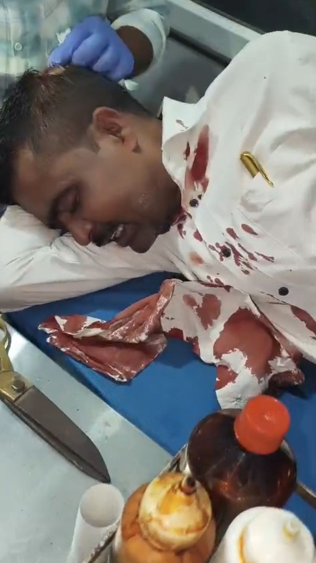 पिटाई से घायल अधिवक्ता व उनके साथी।