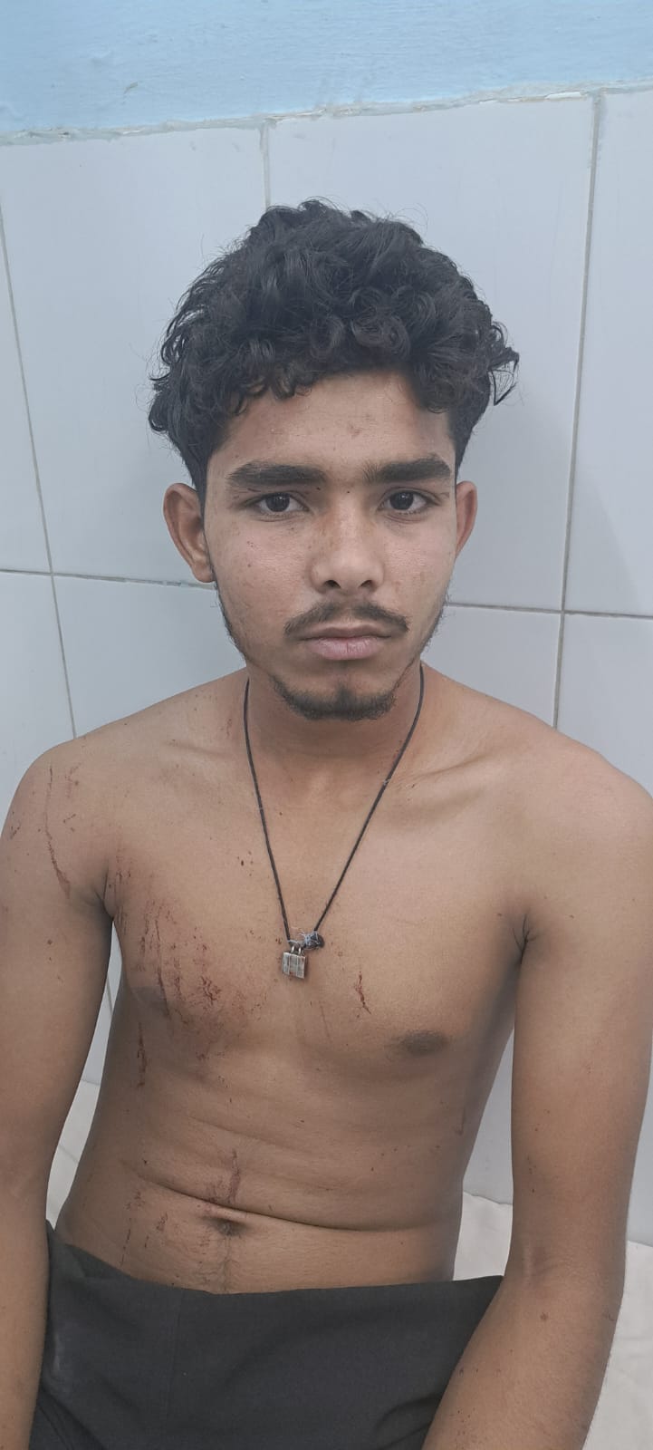 सरधना। कालंद चुंगी पर मारपीट में घायल व्यक्ति। संवाद सरधना। कालंद चुंगी पर मारपीट में घायल व्यक्ति। संवाद