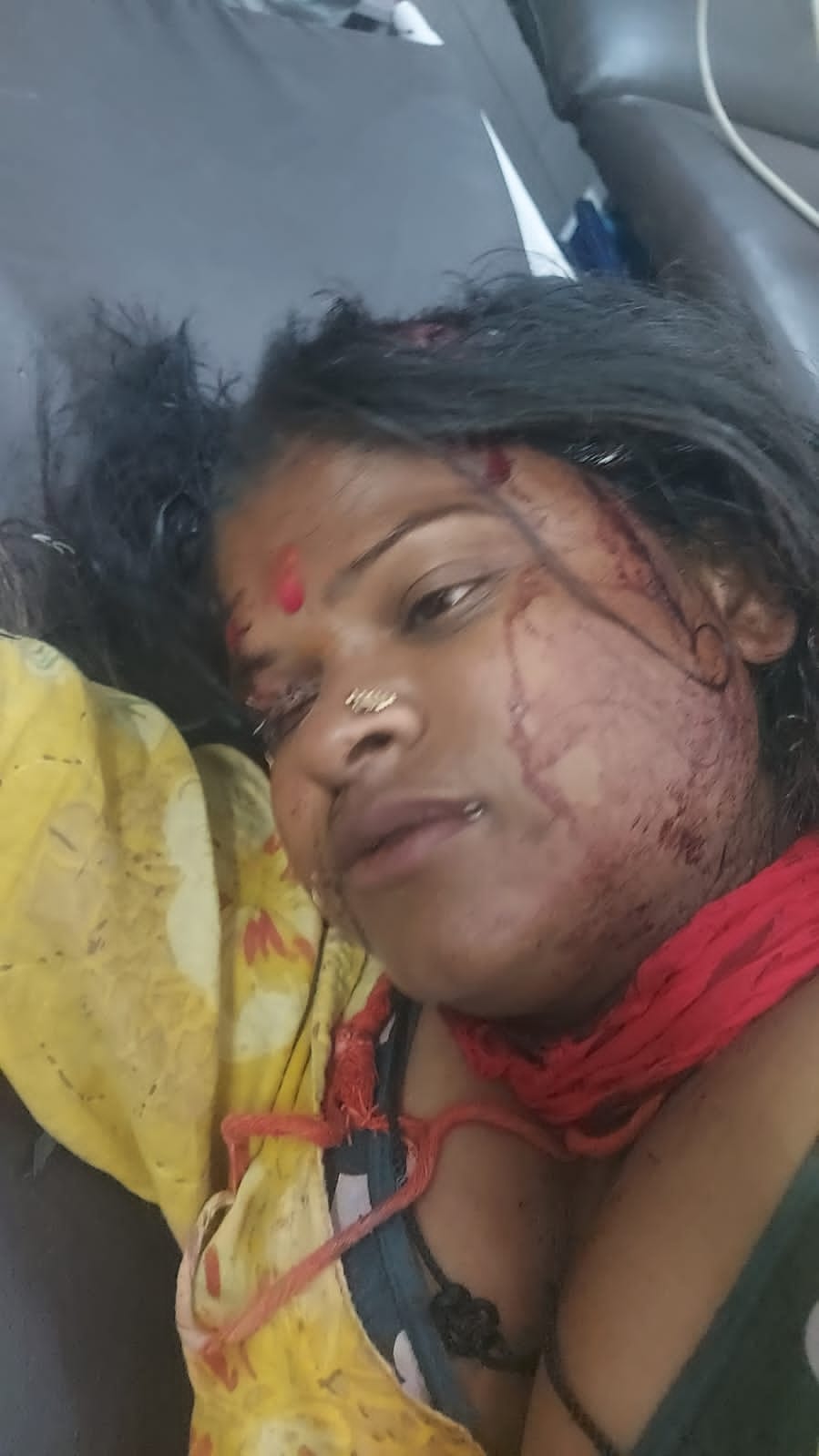 कैला भट्टा में हुए हमले में घायल श्रद्धालु। संवाद