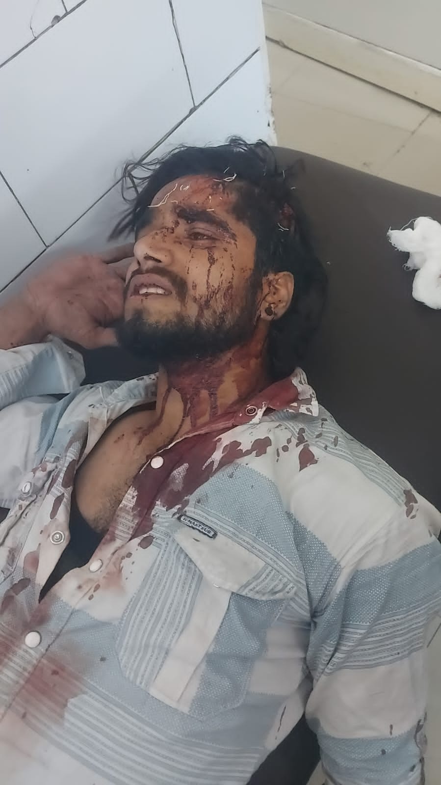 कैला भट्टा में हुए हमले में घायल श्रद्धालु। संवाद
