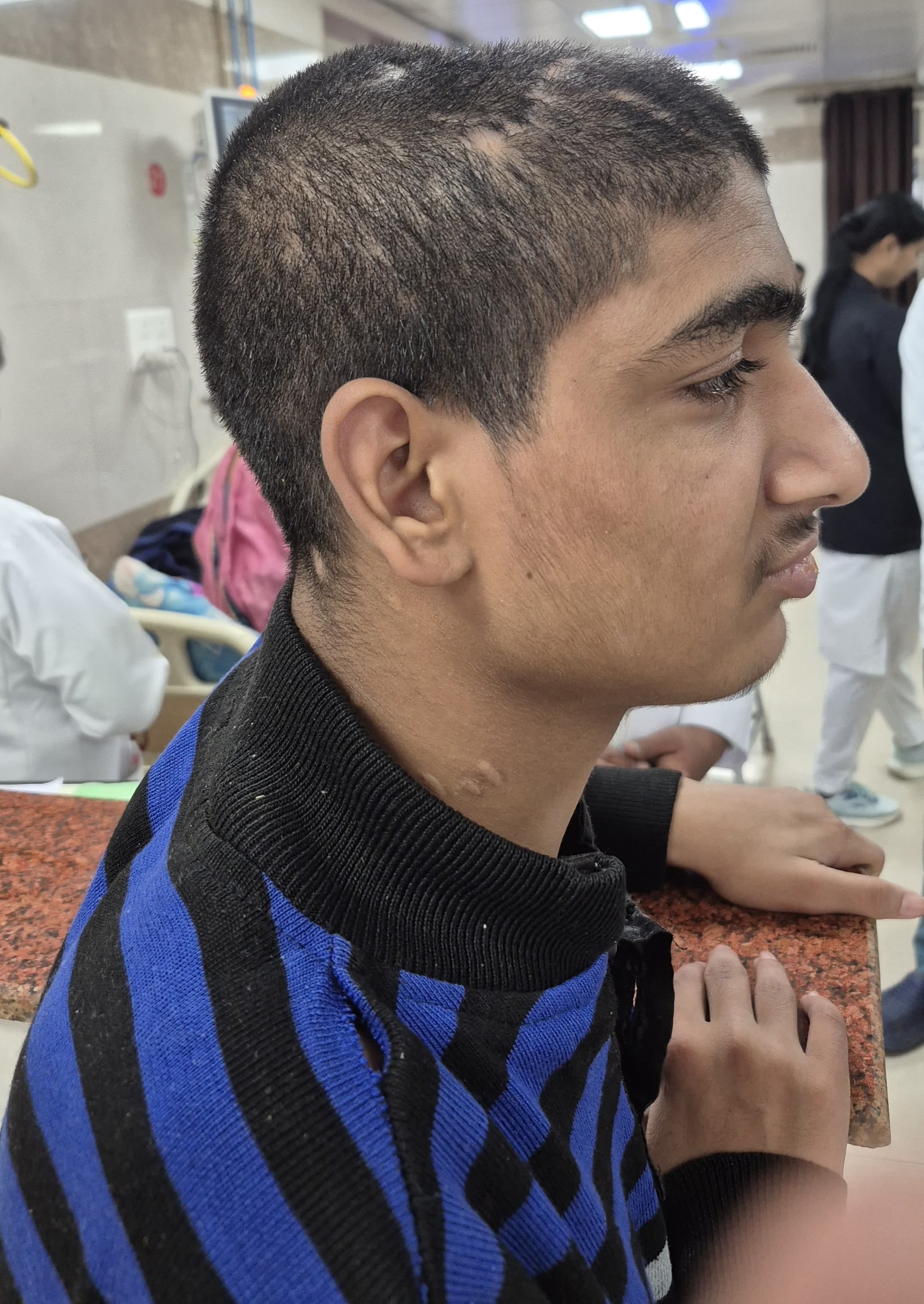 केजीएमयू में भर्ती लावारिस किशोर