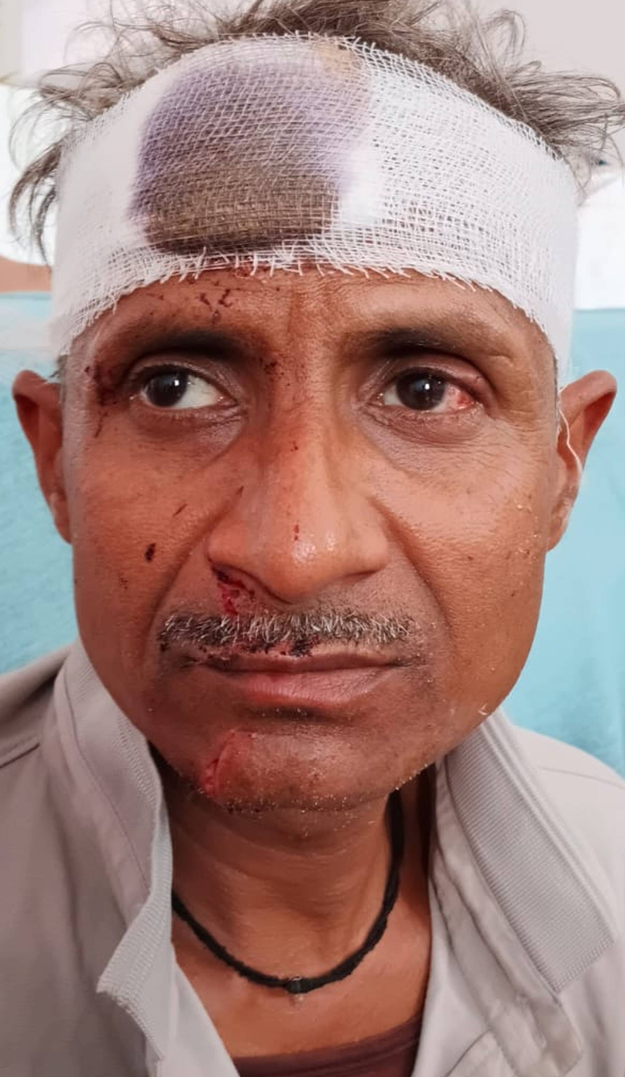 फोटो-35-क्षतिग्रस्त स्कूली बस के पास मौजूद भीड़। संवाद फोटो-35-क्षतिग्रस्त स्कूली बस के पास मौजूद भीड़। संवाद