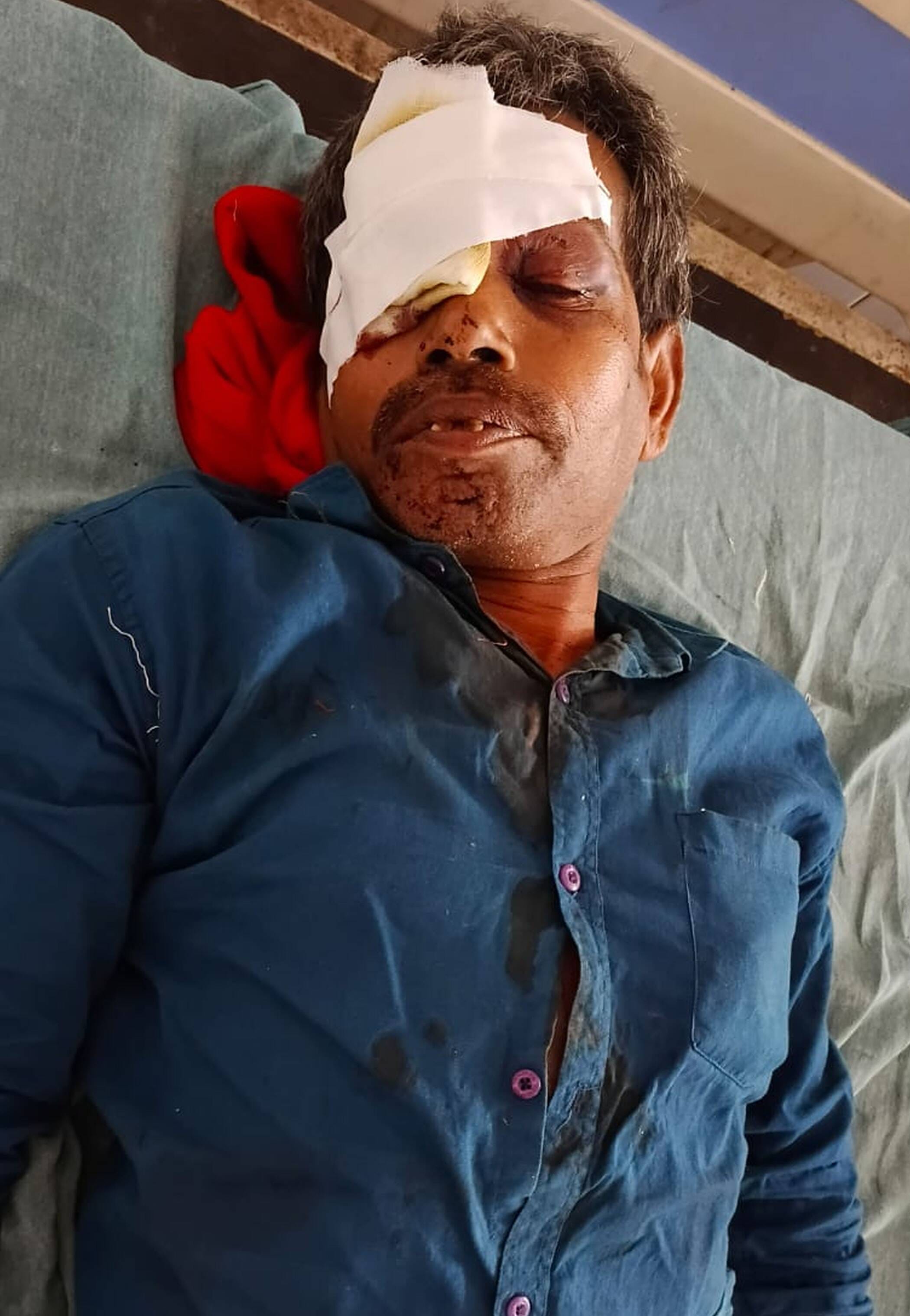 फोटो-35-क्षतिग्रस्त स्कूली बस के पास मौजूद भीड़। संवाद फोटो-35-क्षतिग्रस्त स्कूली बस के पास मौजूद भीड़। संवाद