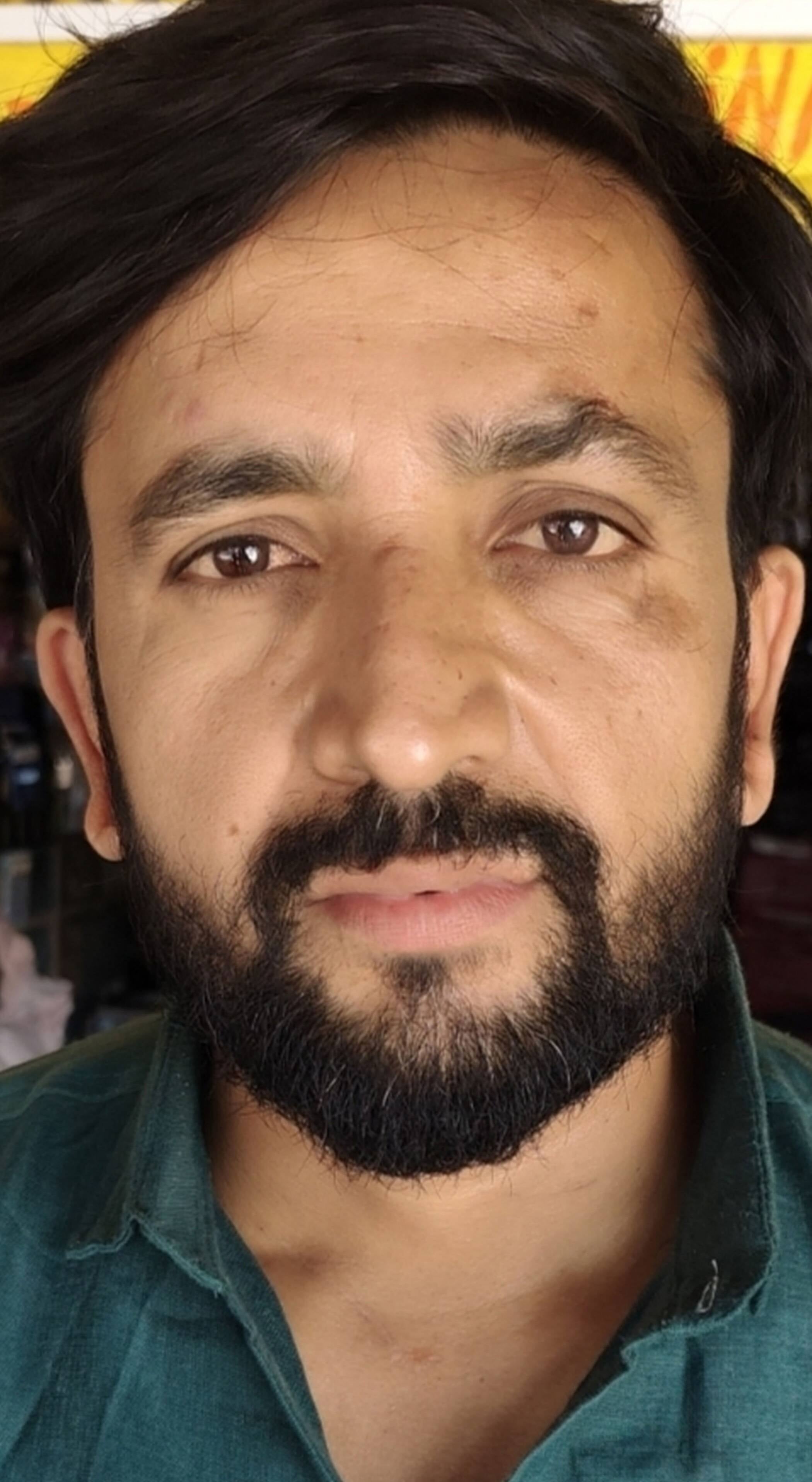 फोटो-14-गौरा-हरिजनपुर मार्ग पर बने गड्ढो में जलभराव के बीच निकलते राहगीर। संवाद