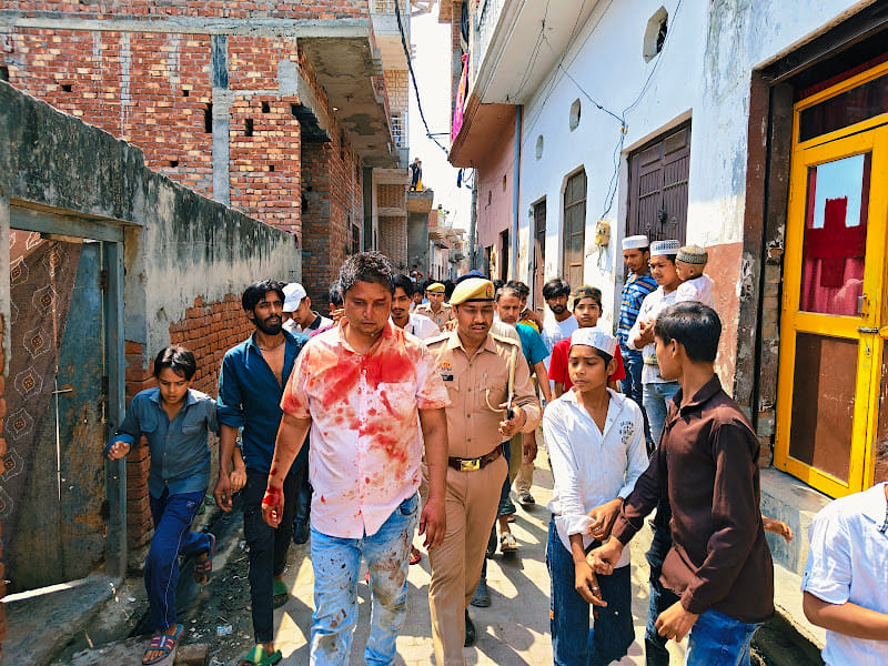 सरधना। ईदगाह रोड मोहल्ले में छुरी से हमले के बाद अस्पताल में भर्ती घायल महिला। संवाद