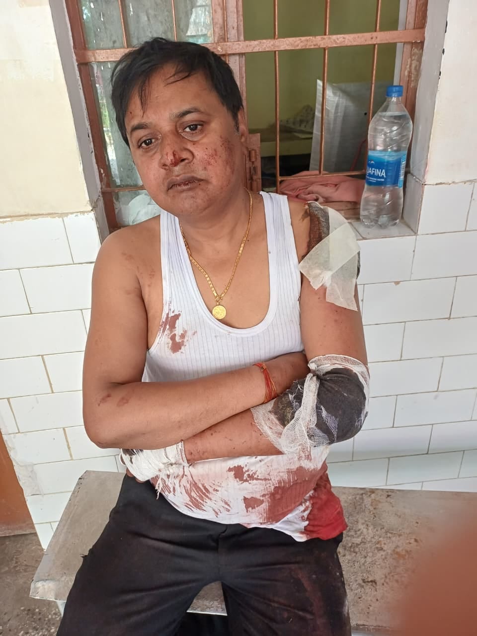 फोटो-19-घटना में घायल शिल्पी। संवाद फोटो-19-घटना में घायल शिल्पी। संवाद