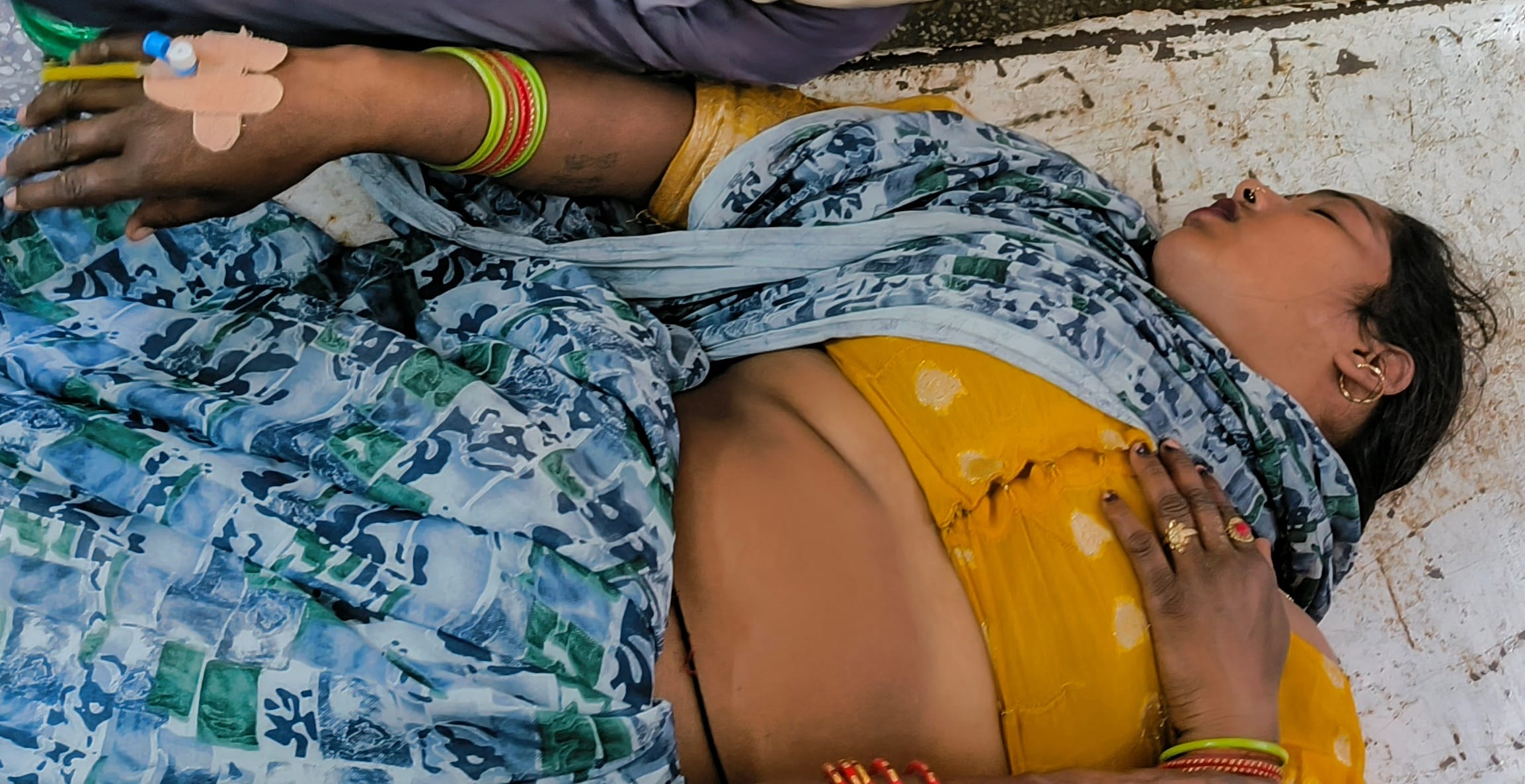 हादसे में जख्मी बच्चे। संवाद