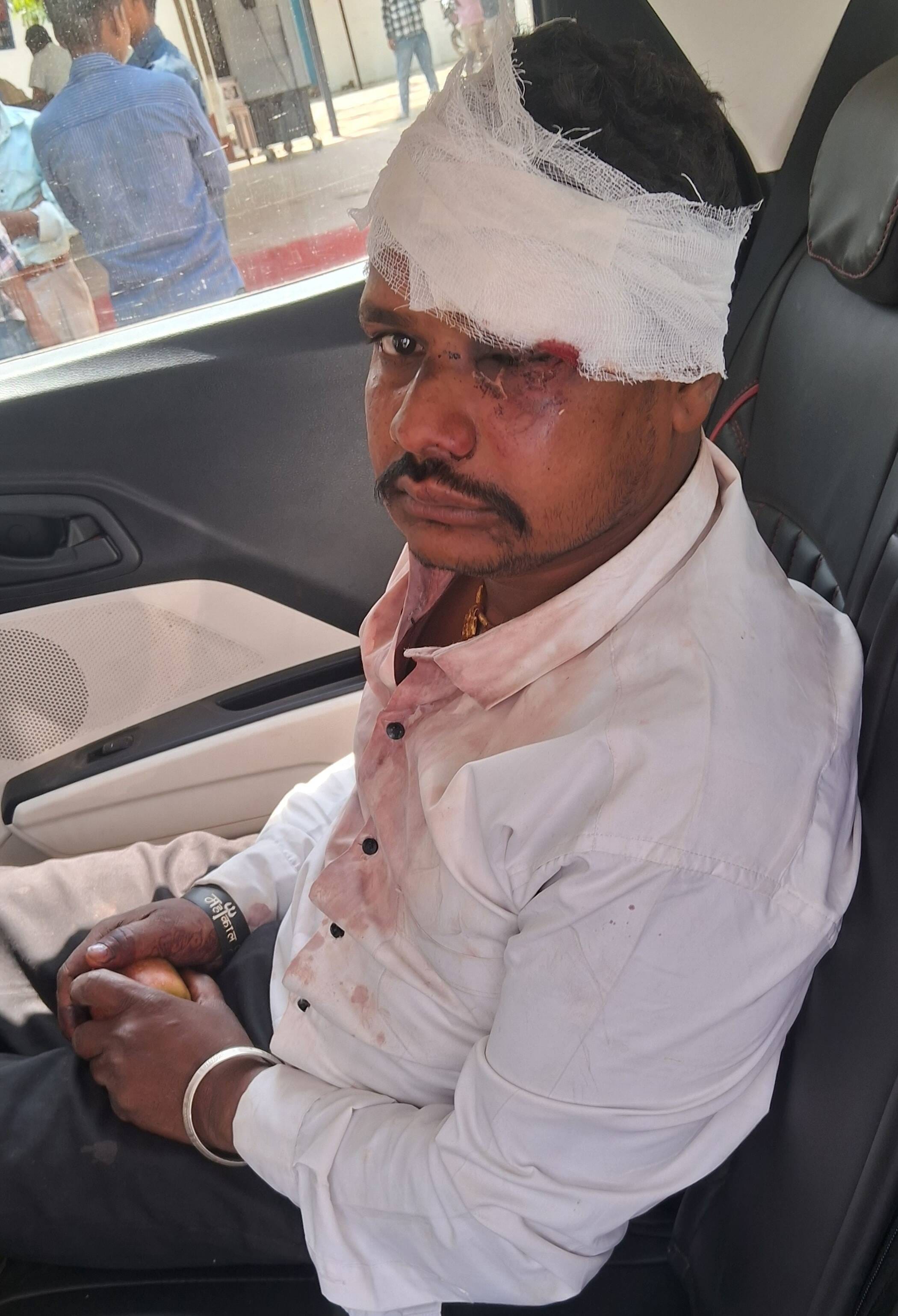 फोटो-18-क्षतिग्रस्त थार गाड़ी। संवाद