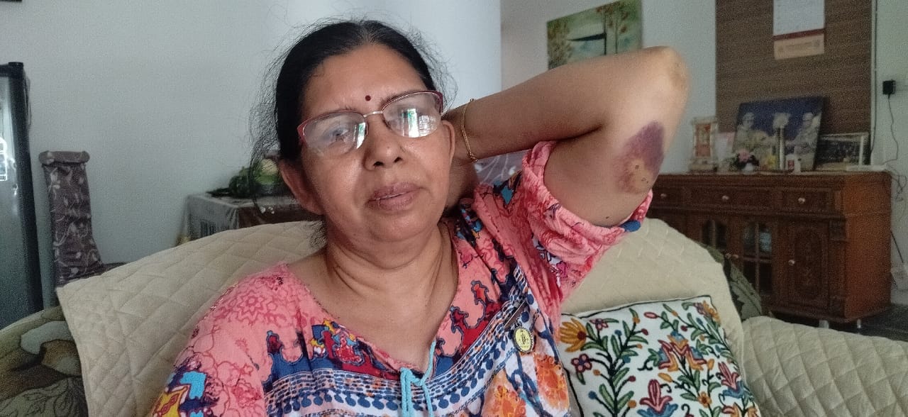 कुरुक्षेत्र। जिंदल सिटी में घूम रहे आवारा कुत्ते। संवाद कुरुक्षेत्र। जिंदल सिटी में घूम रहे आवारा कुत्ते। संवाद