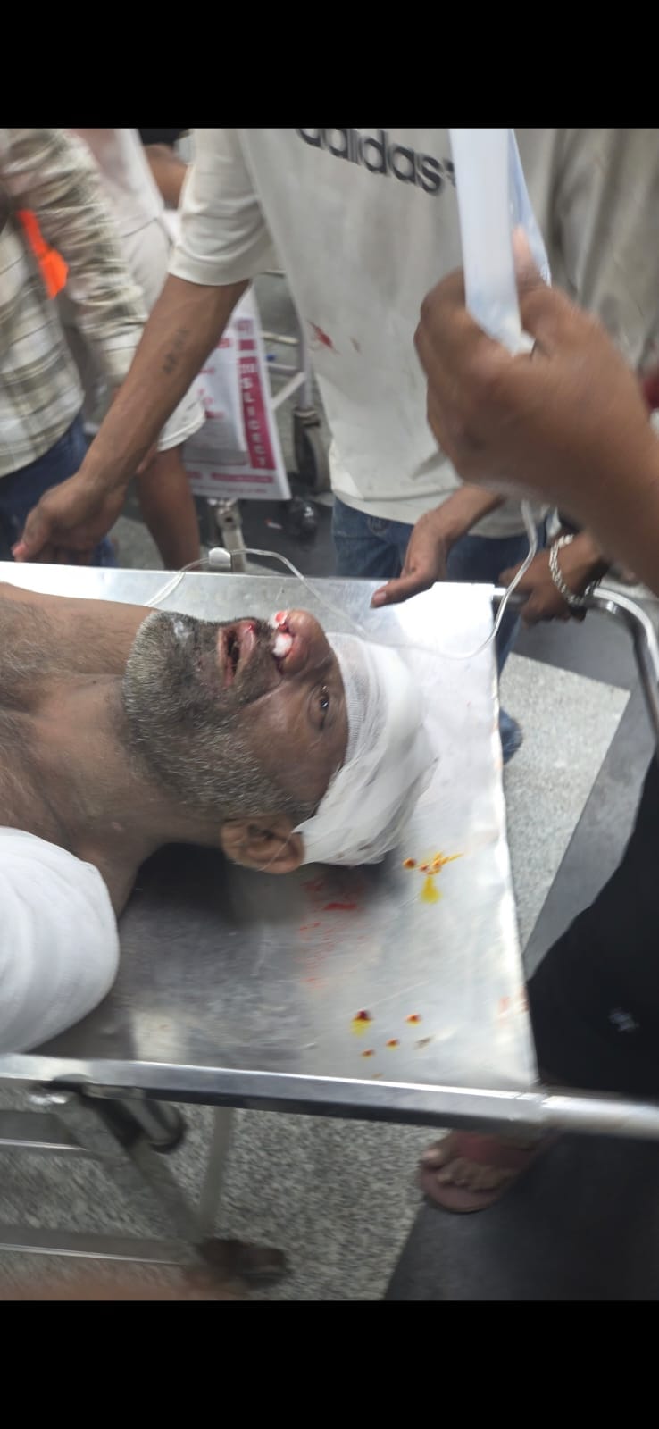 बिजली के लिए उपकेंद्र में हंगामा करते लोग और बिजली से झुलसा कर्मचारी। बिजली के लिए उपकेंद्र में हंगामा करते लोग और बिजली से झुलसा कर्मचारी।