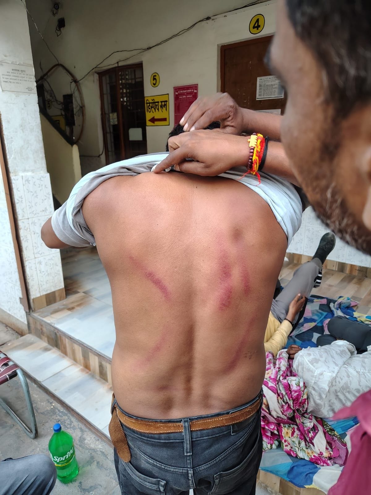 कर्मचारियों के पीट व पैर पर चोट के निशान और थाने पर एफआईआर दर्ज कराने पहुंचे कर्मचारी। कर्मचारियों के पीट व पैर पर चोट के निशान और थाने पर एफआईआर दर्ज कराने पहुंचे कर्मचारी।