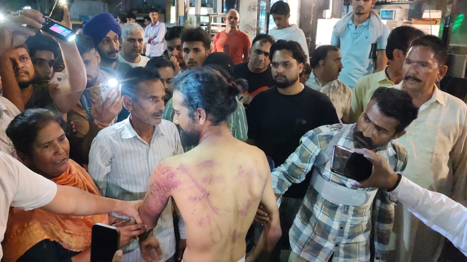 युवक को लगी चोटें दिखाते परिजन। संवाद युवक को लगी चोटें दिखाते परिजन। संवाद