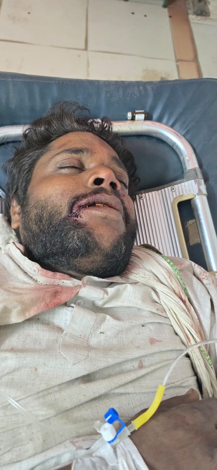 हादसे के बाद क्षतिग्रस्त वाहन व घायल लोग। हादसे के बाद क्षतिग्रस्त वाहन व घायल लोग।