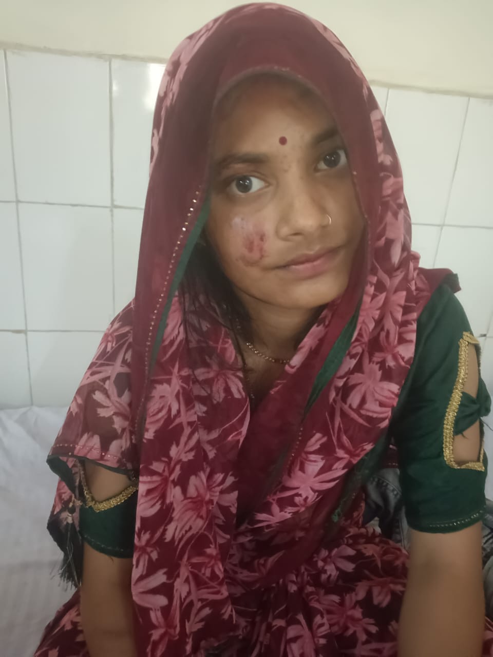 फोटो। बरीपुरा में मारपीट में घायल दोनों पक्षों की महिलाएं सीएचसी में भर्ती