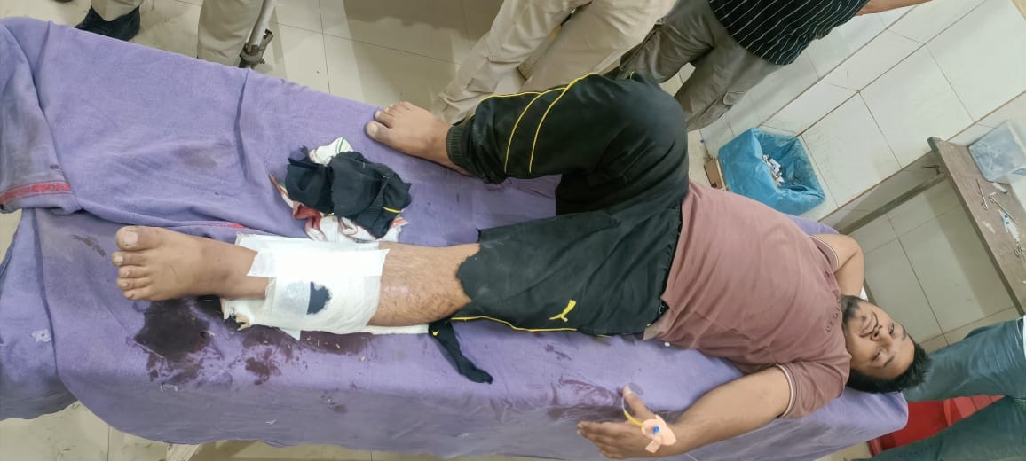 रोहतक पीजीआई में उपचाराधीन मुठभेड़ में घायल आरोपी जितेंद्र उर्फ जीतू। 
