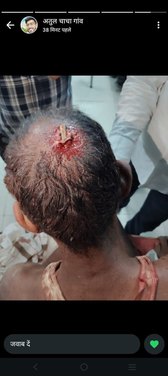 नदौली का पूरा गांव में गुलाब को गोली लगने से घायल की सूचना पर जुटी ग्रामीणों की भीड़। संवाद