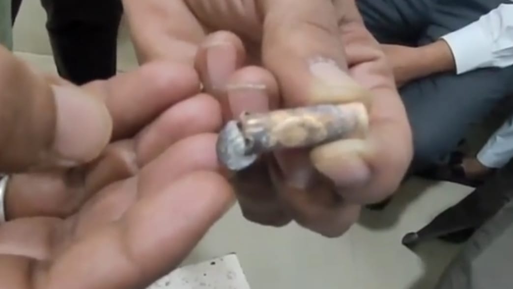 सिर में कारतूस मिलने से सनसनी, 17 वर्षीय बालिका गंभीर हालत में भर्ती; जिला अस्पताल में डॉ ने नि