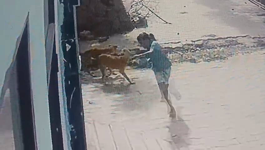 चाचा के घर जा रही 8 साल की मासूम के पीछे पड़े तीन कुत्ते। चाचा के घर जा रही 8 साल की मासूम के पीछे पड़े तीन कुत्ते।