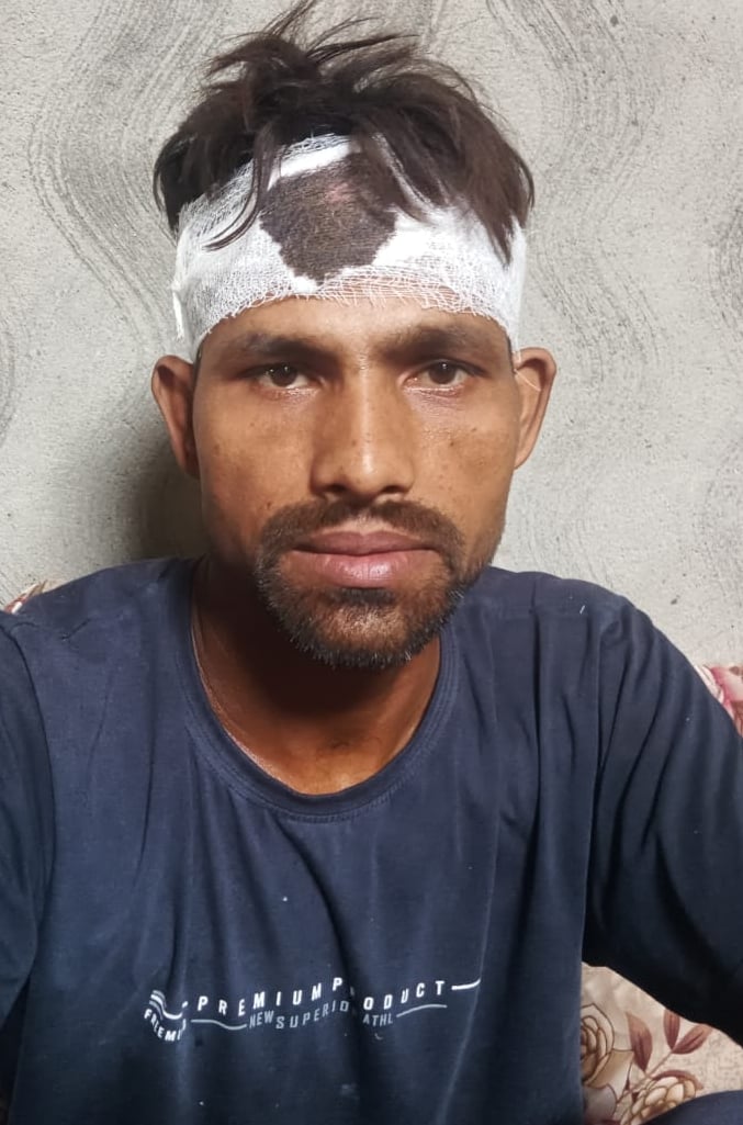 पिलखुवा में रात के समय आई आंधी के दौरान मकान की दीवार गिरने से घायल हुई महिला। संवाद पिलखुवा में रात के समय आई आंधी के दौरान मकान की दीवार गिरने से घायल हुई महिला। संवाद