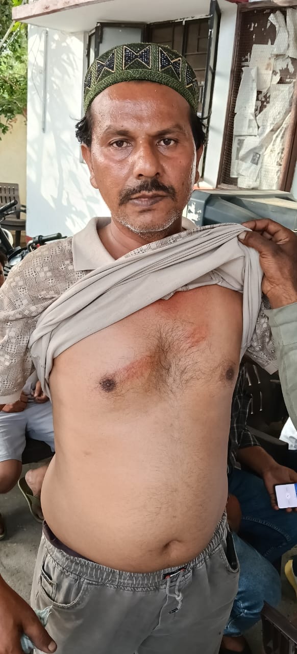 जानसठ के गांव वाजिदपुर कवाली व नाईपुरा के रास्ते पर बंदर के हमले से घायल बाइक सवार युवक। स्रोत जानसठ के गांव वाजिदपुर कवाली व नाईपुरा के रास्ते पर बंदर के हमले से घायल बाइक सवार युवक। स्रोत