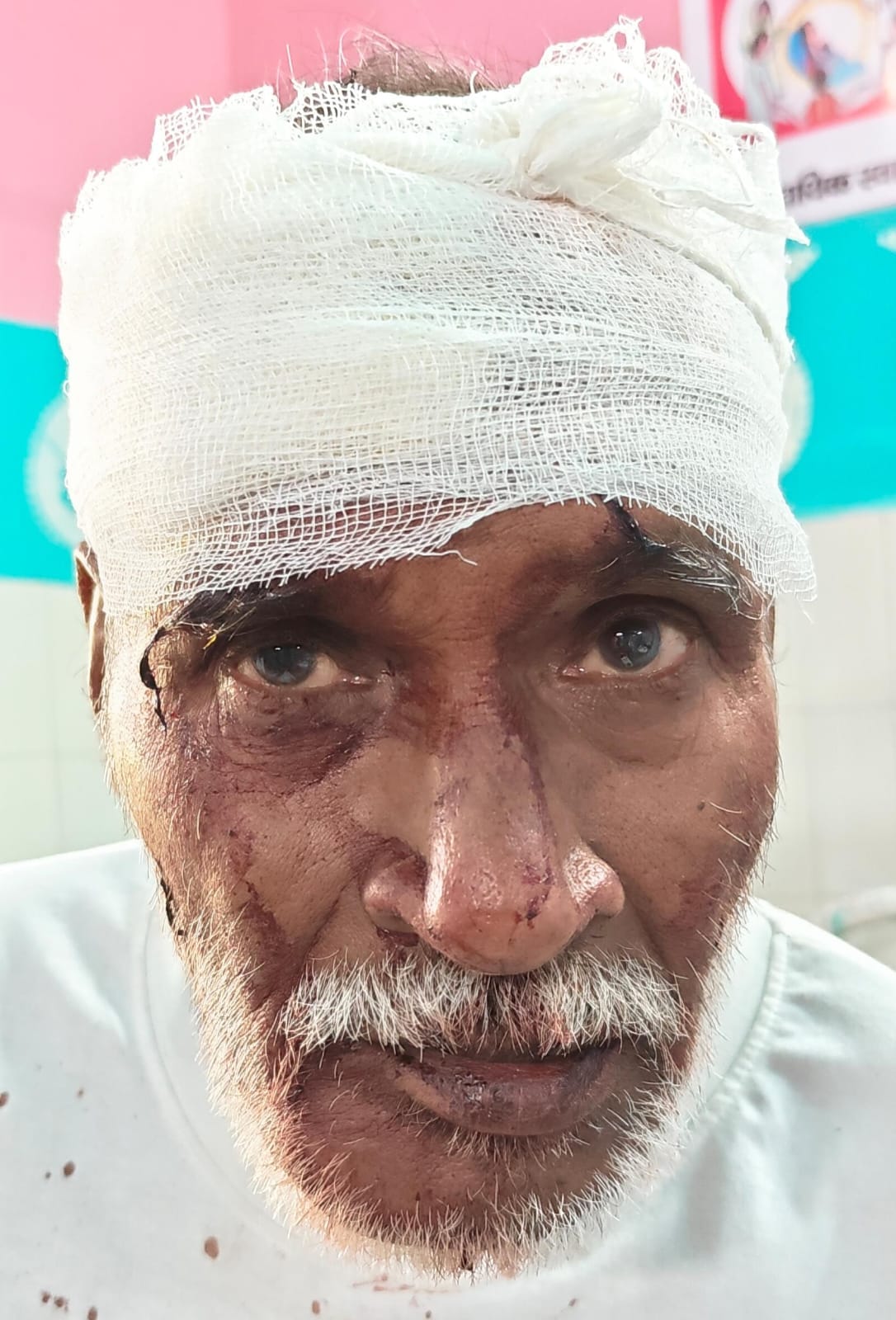 फोटो - 17 हादसे के बाद पलटी बस, मौके पर जांच पड़ताल करते एसडीएम हेमंत पटेल व सीओ परमेश्वर प्रसाद फोटो - 17 हादसे के बाद पलटी बस, मौके पर जांच पड़ताल करते एसडीएम हेमंत पटेल व सीओ परमेश्वर प्रसाद