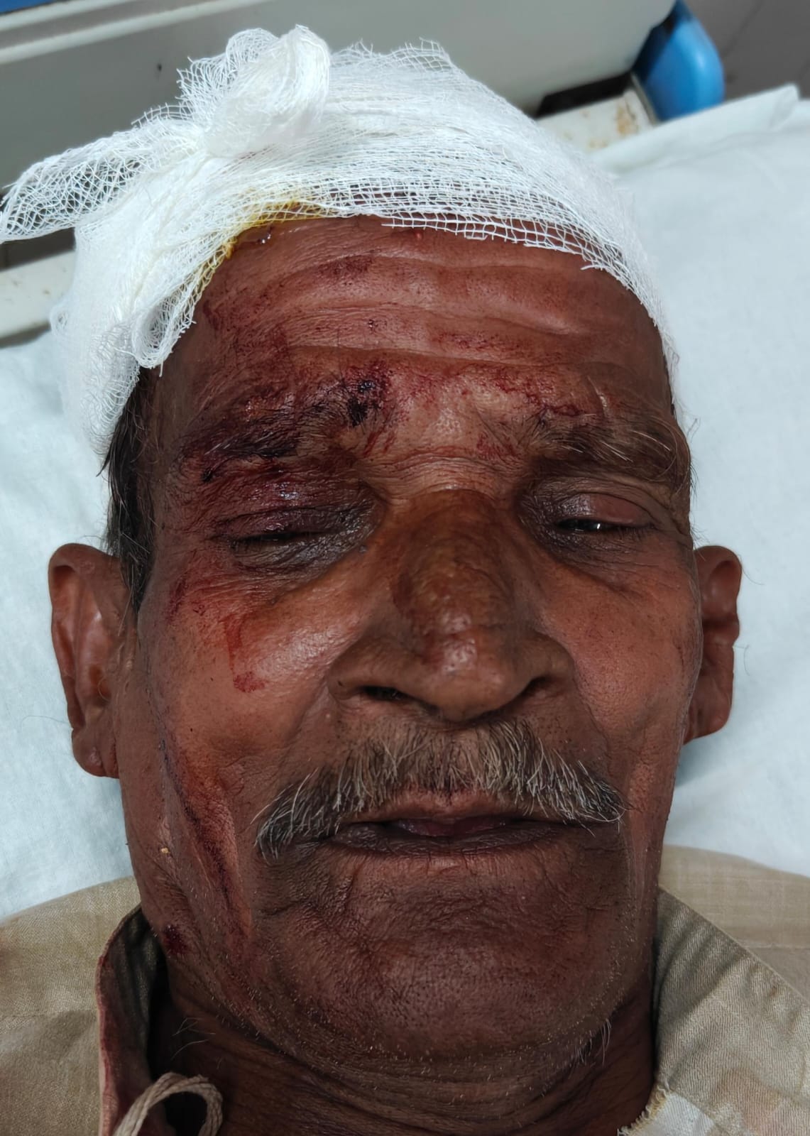 फोटो - 17 हादसे के बाद पलटी बस, मौके पर जांच पड़ताल करते एसडीएम हेमंत पटेल व सीओ परमेश्वर प्रसाद फोटो - 17 हादसे के बाद पलटी बस, मौके पर जांच पड़ताल करते एसडीएम हेमंत पटेल व सीओ परमेश्वर प्रसाद