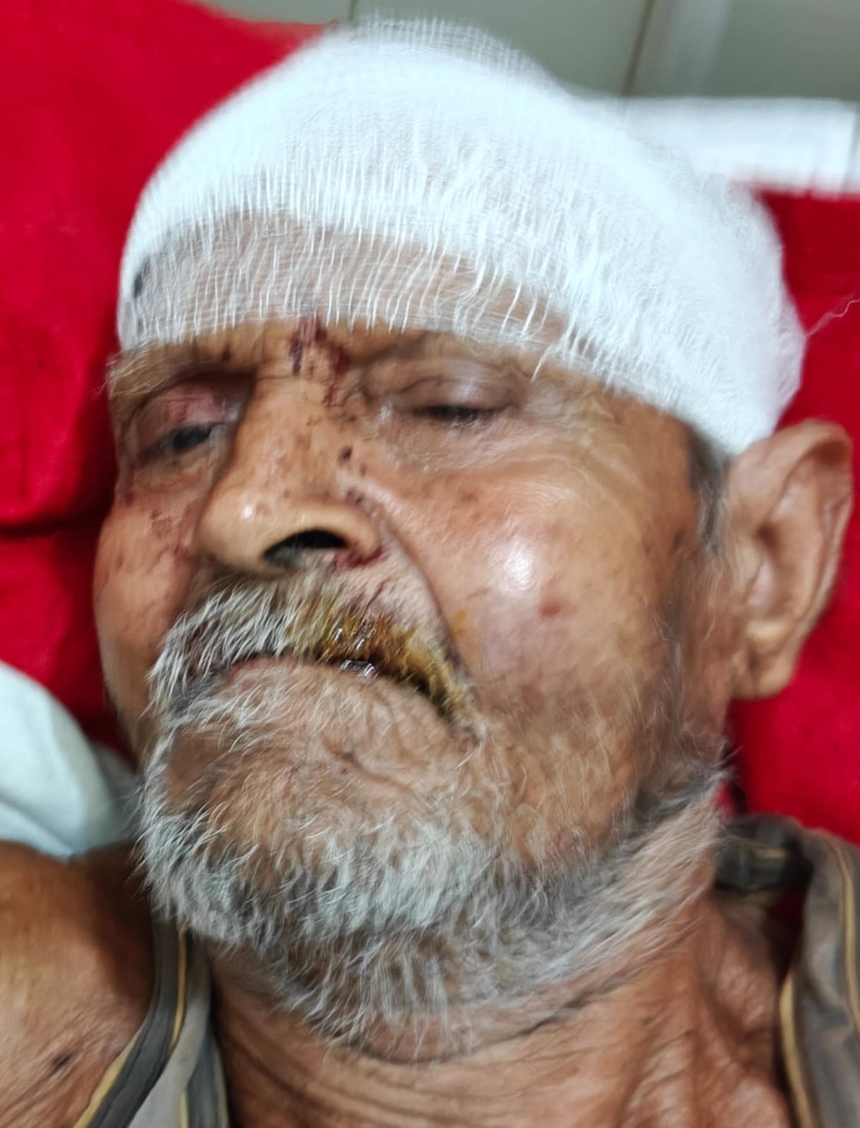 फोटो - 17 हादसे के बाद पलटी बस, मौके पर जांच पड़ताल करते एसडीएम हेमंत पटेल व सीओ परमेश्वर प्रसाद फोटो - 17 हादसे के बाद पलटी बस, मौके पर जांच पड़ताल करते एसडीएम हेमंत पटेल व सीओ परमेश्वर प्रसाद