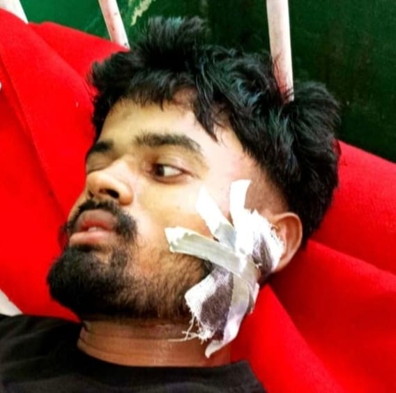 बांकेगंज में रेलवे प्लेटफार्म से सटी सड़क पर लंगूर को खदेड़ते यात्री। स्रोत : सोशल मीडिया। बांकेगंज में रेलवे प्लेटफार्म से सटी सड़क पर लंगूर को खदेड़ते यात्री। स्रोत : सोशल मीडिया।