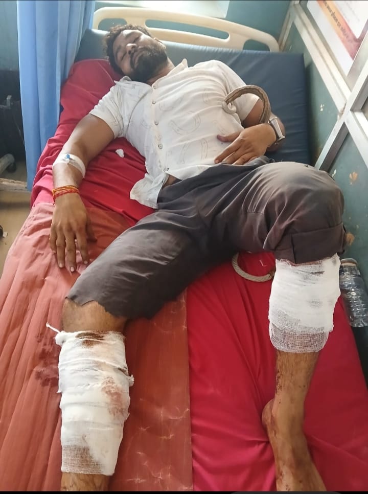 मुठभेड़ में घायल आरोपी मुठभेड़ में घायल आरोपी