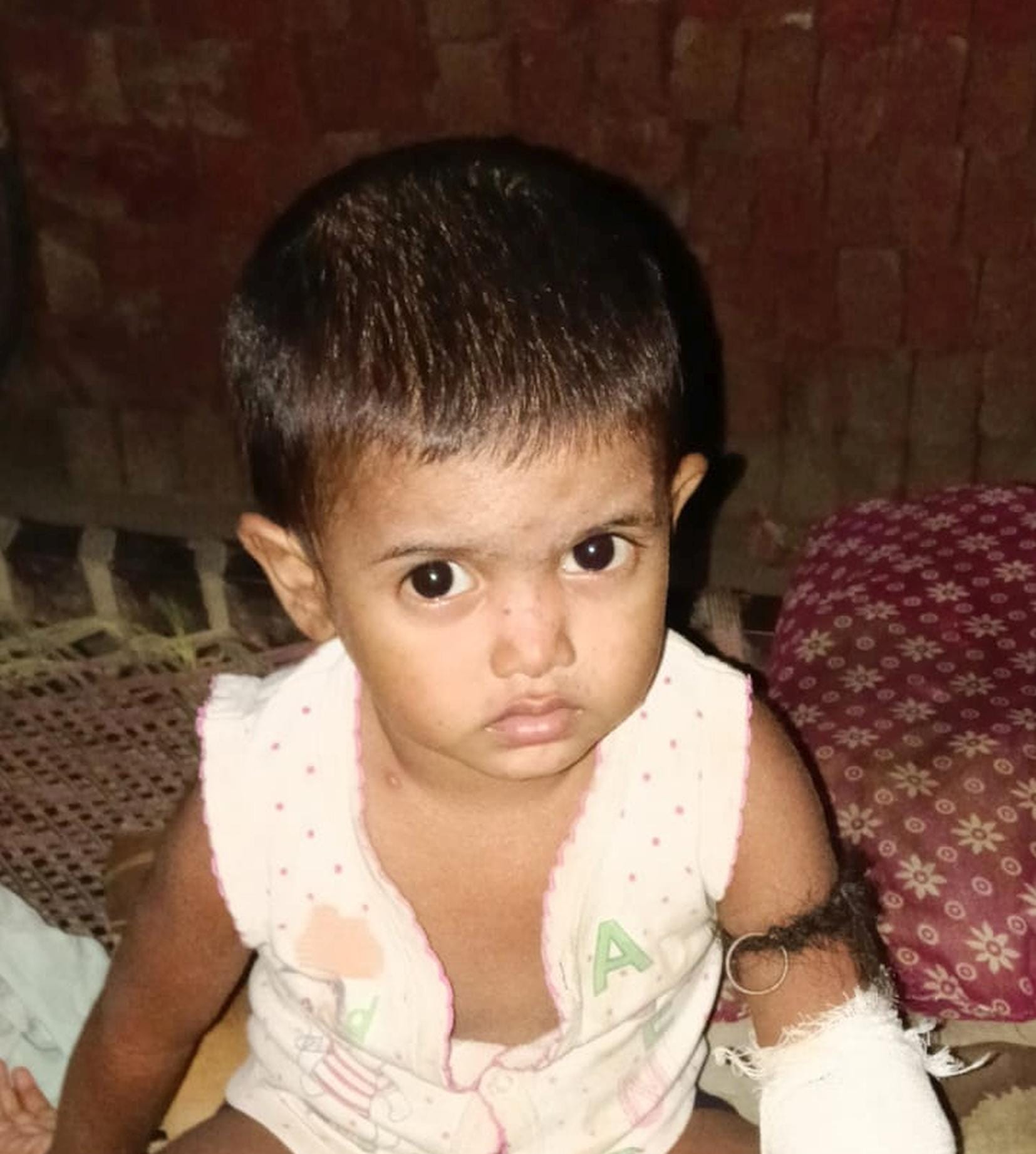 कुत्ते के हमले में घायल बच्चे।