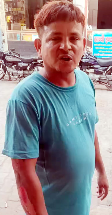 बाह: महिला की सेल्फी के चक्कर में ऑटो पलटने से घायल हुई सुशीला देवी बाह: महिला की सेल्फी के चक्कर में ऑटो पलटने से घायल हुई सुशीला देवी