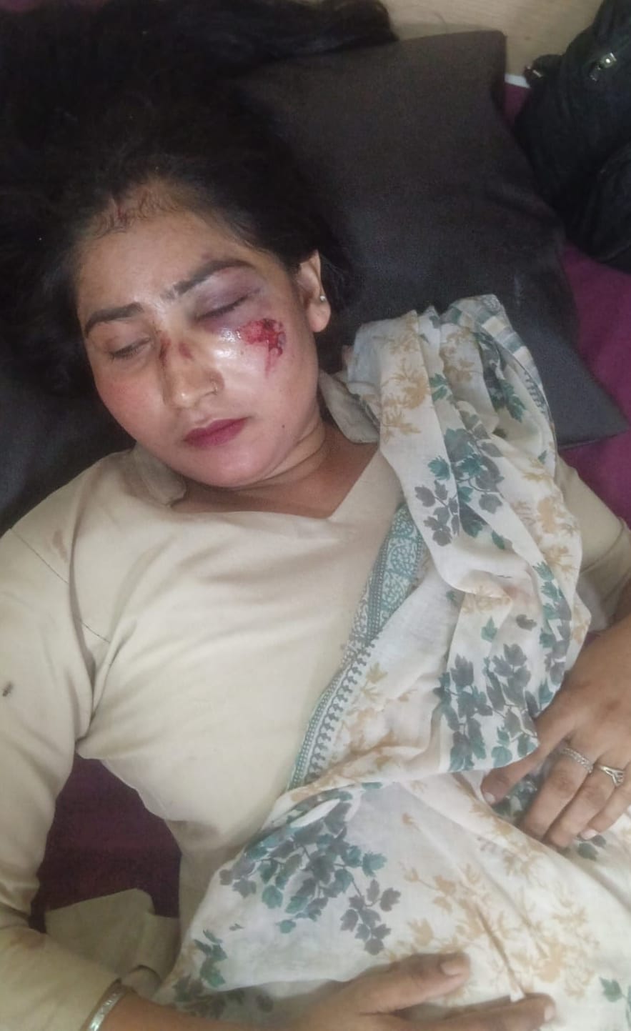 अस्पताल में भर्ती निजामपुर अंडरपास पर हुई सड़क दुर्घटना में घायल  युवती। संवाद