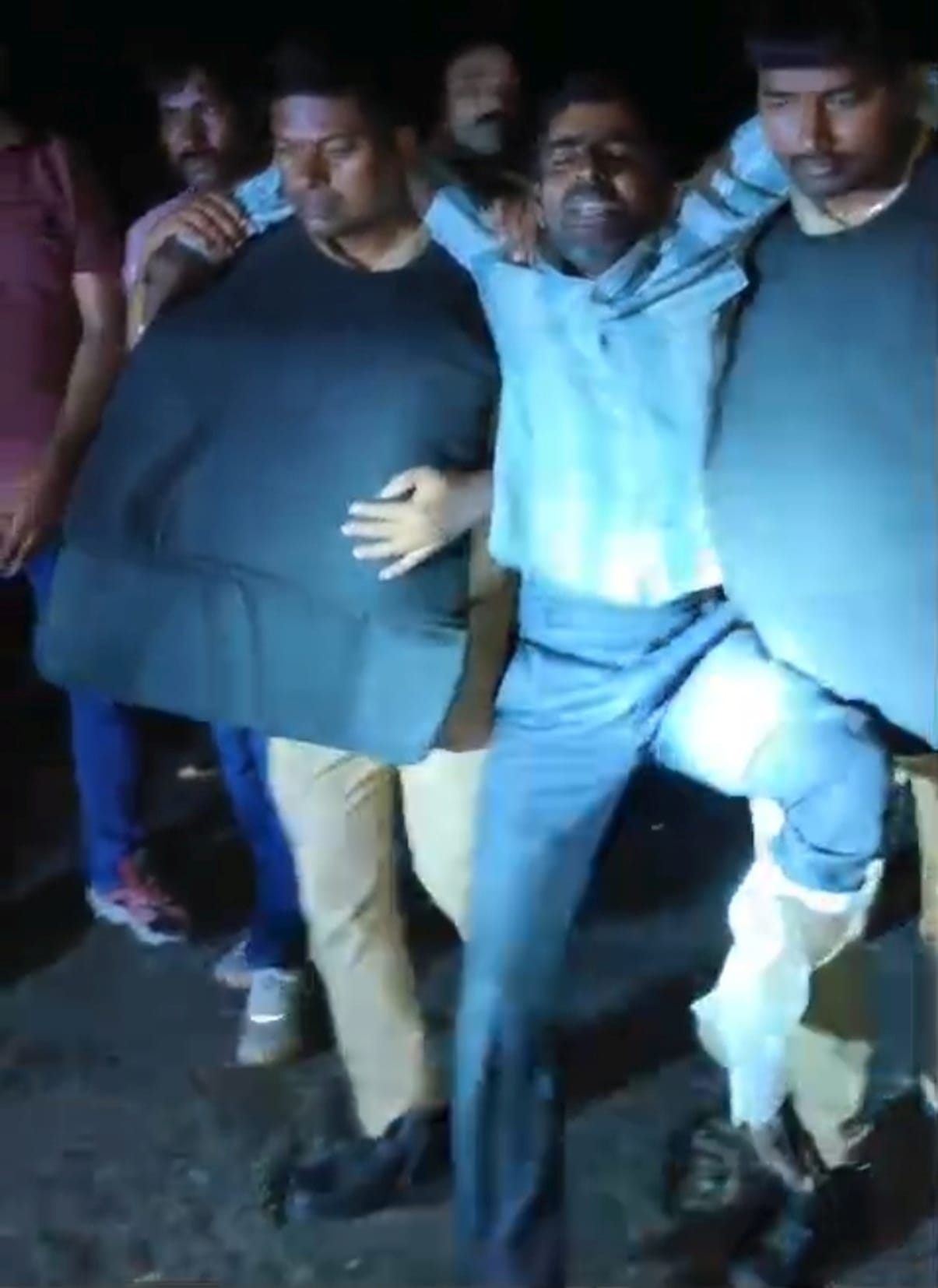 मुठभेड़ में पुलिस की गोली से घायल बदमाश। मुठभेड़ में पुलिस की गोली से घायल बदमाश।