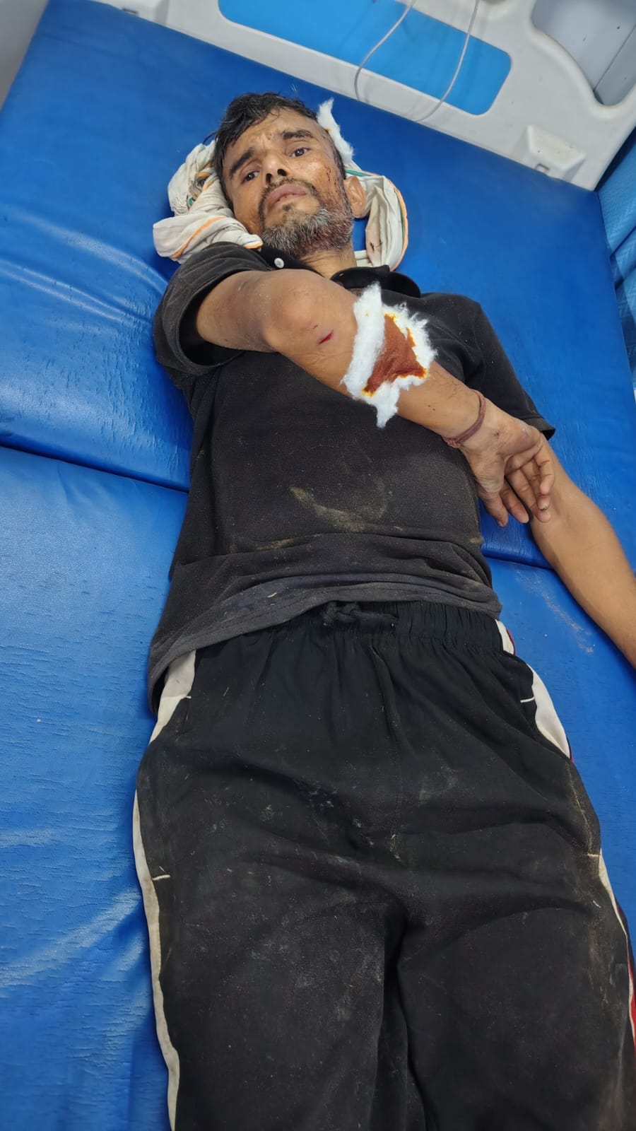 सरूरपुर। कस्बा खिवाई में मारपीट में घायल युवक। संवाद सरूरपुर। कस्बा खिवाई में मारपीट में घायल युवक। संवाद