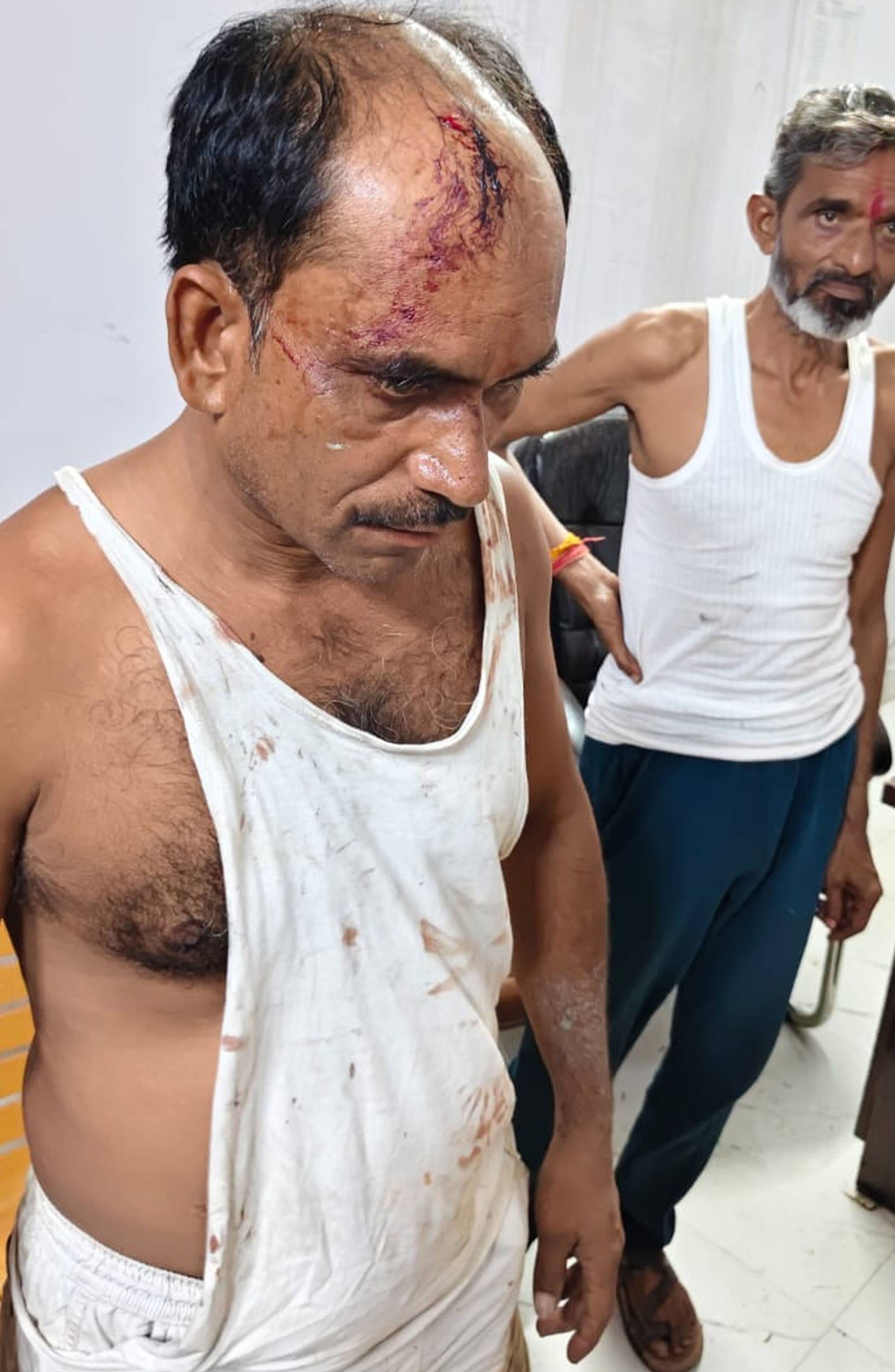 फोटो-30-घायल आशीष तिवारी। संवाद फोटो-30-घायल आशीष तिवारी। संवाद
