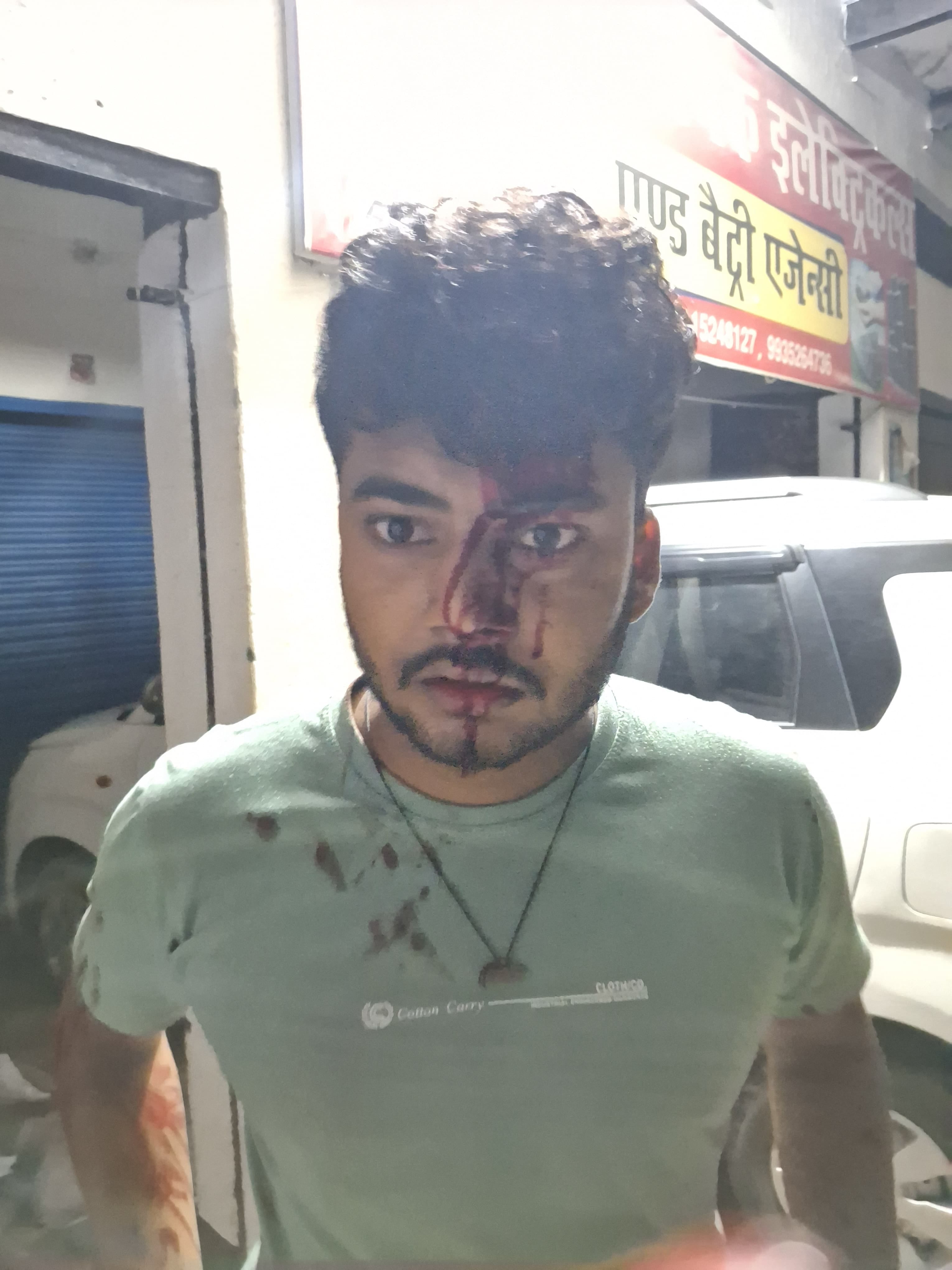 बरसठी क्षेत्र बारीगांव में चाचा ने किए भतीजे को कुल्हाड़ी से किए गये वार में प्रयोग की कई कुल्हा बरसठी क्षेत्र बारीगांव में चाचा ने किए भतीजे को कुल्हाड़ी से किए गये वार में प्रयोग की कई कुल्हा