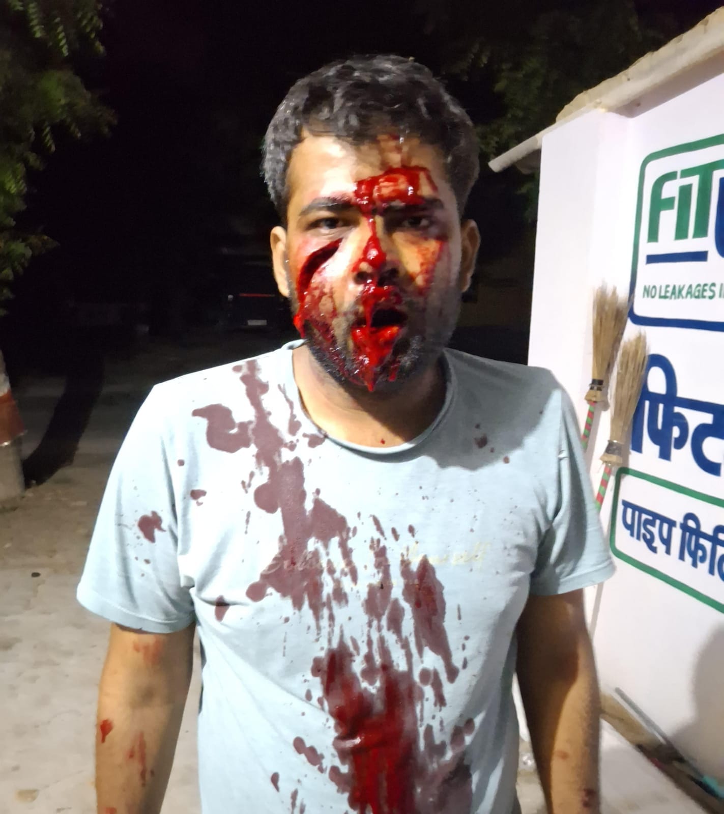 बरसठी क्षेत्र बारीगांव में चाचा ने किए भतीजे को कुल्हाड़ी से किए गये वार में प्रयोग की कई कुल्हा बरसठी क्षेत्र बारीगांव में चाचा ने किए भतीजे को कुल्हाड़ी से किए गये वार में प्रयोग की कई कुल्हा