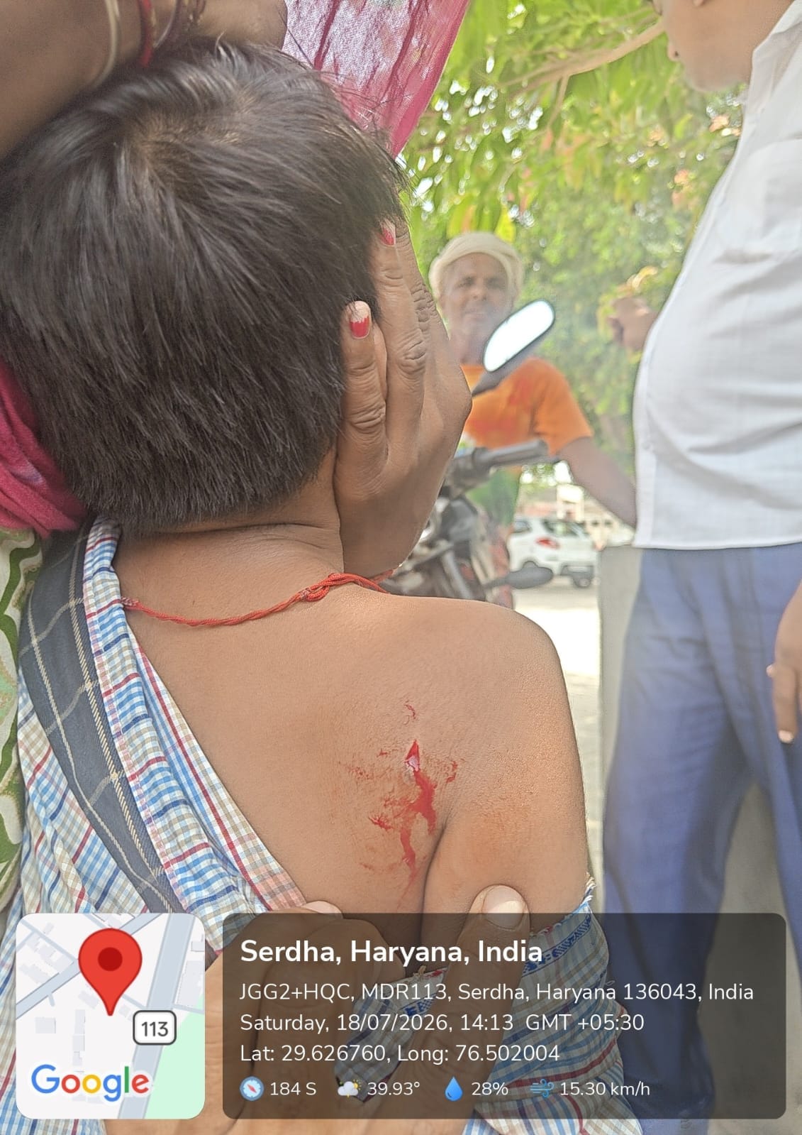 बंदर के हमले में स्कूली छात्रा घायल, लोगों में रोष बंदर के हमले में स्कूली छात्रा घायल, लोगों में रोष