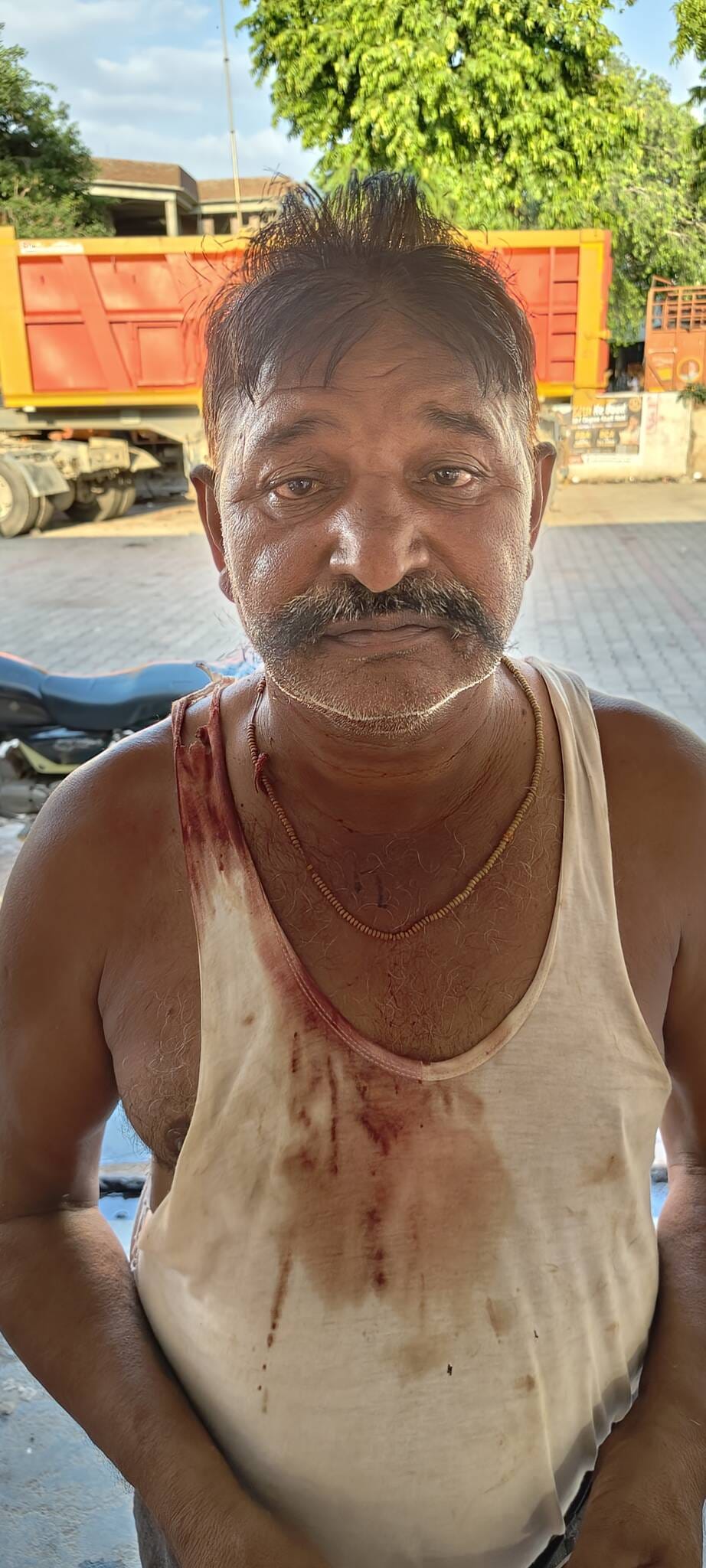 फतेहाबाद फोटो।मारपीट में घायल सगे भाई फतेहाबाद फोटो।मारपीट में घायल सगे भाई