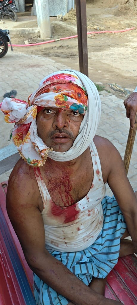 फतेहाबाद फोटो।मारपीट में घायल सगे भाई फतेहाबाद फोटो।मारपीट में घायल सगे भाई