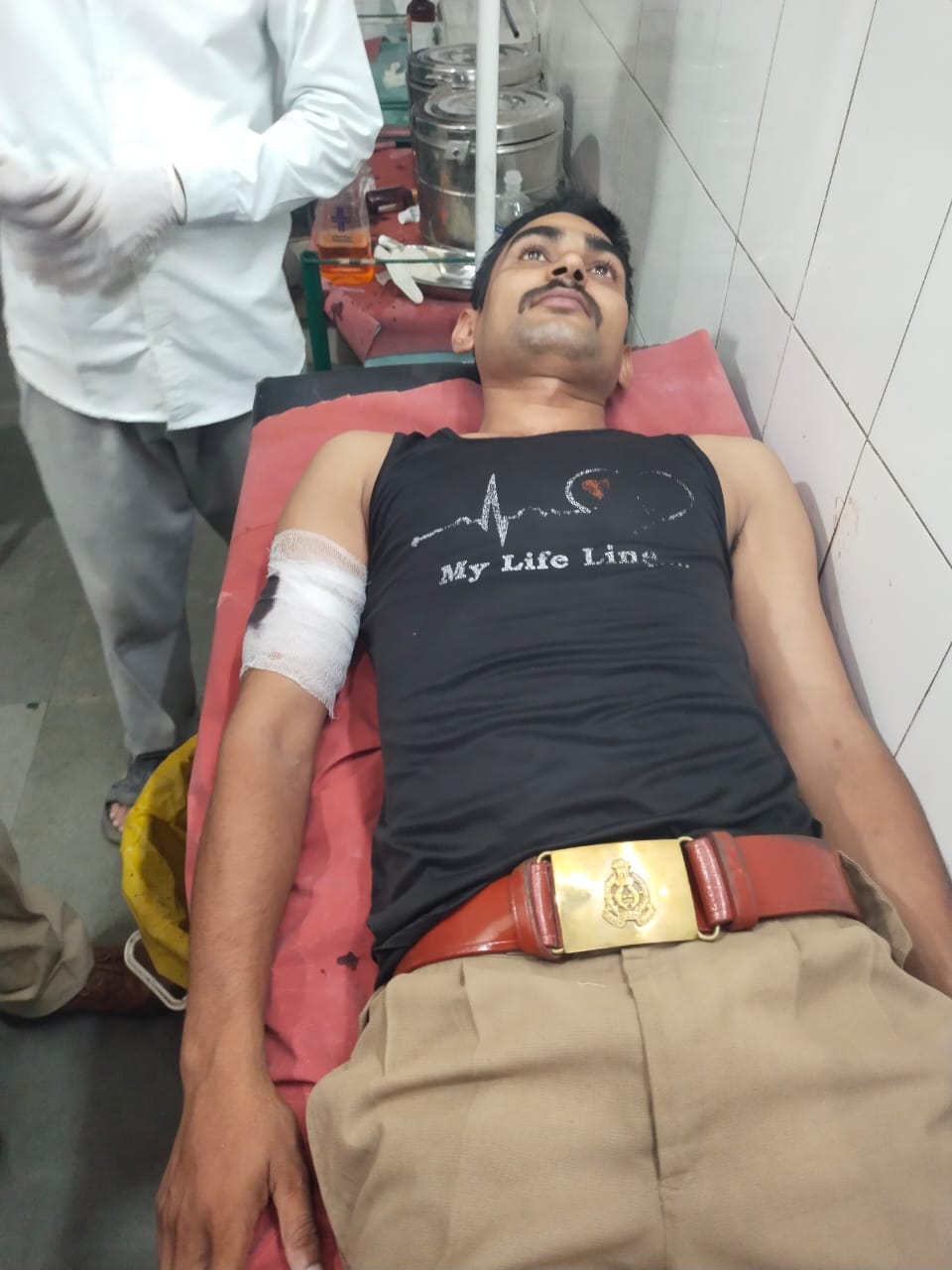 फोटो 25 सीकेटीपी 27 मुठभेड़ में घायल आरोपी को लाती पुलिस। संवाद